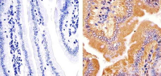 JPH2 Antibody in Immunohistochemistry (Paraffin) (IHC (P))