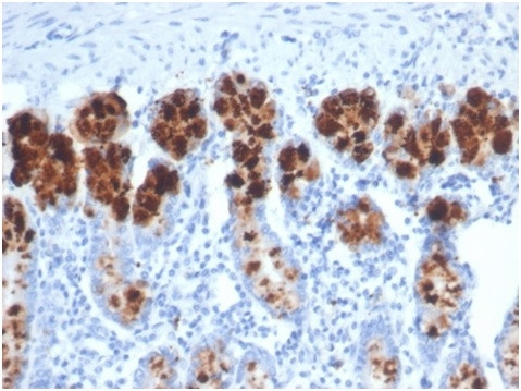 Lysozyme (Histiocytoma andMonocytic Acute Leukemia Marker) Antibody in SDS-PAGE (SDS-PAGE)