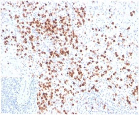 Lysozyme (Histiocytoma andMonocytic Acute Leukemia Marker) Antibody in Immunohistochemistry (Paraffin) (IHC (P))