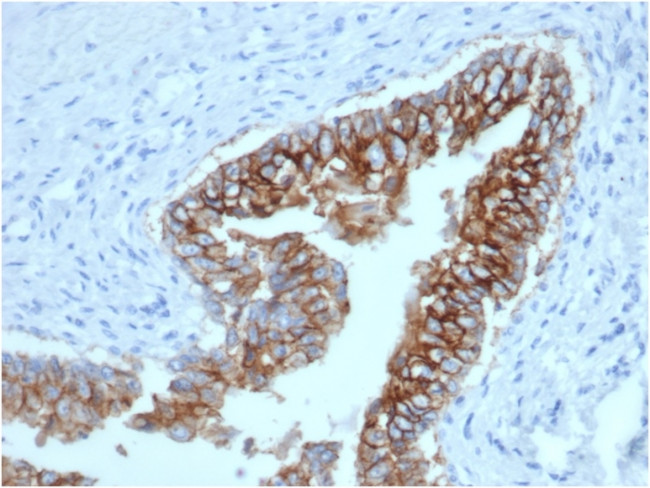 Ep-CAM/CD326 (Extracellular Domain) (Epithelial Marker) Antibody in Immunohistochemistry (Paraffin) (IHC (P))