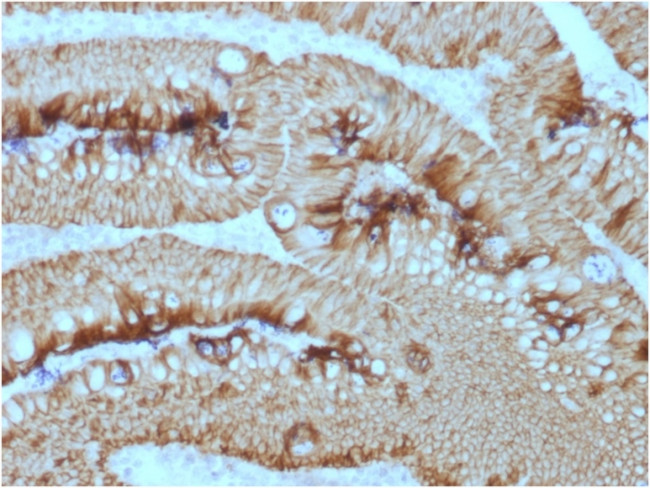 Ep-CAM/CD326 (Extracellular Domain) (Epithelial Marker) Antibody in Immunohistochemistry (Paraffin) (IHC (P))