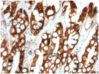 Ep-CAM/CD326 (Extracellular Domain) (Epithelial Marker) Antibody in Immunohistochemistry (Paraffin) (IHC (P))