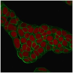 Ep-CAM/CD326 (Extracellular Domain) (Epithelial Marker) Antibody in Immunocytochemistry (ICC/IF)