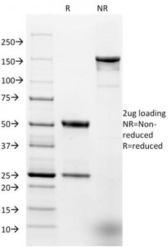 Ep-CAM/CD326 (Extracellular Domain) (Epithelial Marker) Antibody in SDS-PAGE (SDS-PAGE)