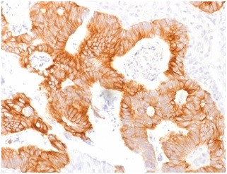 Ep-CAM/CD326 (Extracellular Domain) (Epithelial Marker) Antibody in Immunohistochemistry (Paraffin) (IHC (P))