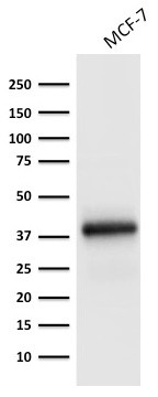 Ep-CAM/CD326 (Extracellular Domain) (Epithelial Marker) Antibody in Western Blot (WB)