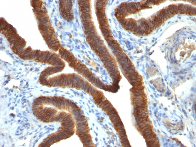 Ep-CAM/CD326 Antibody in Immunohistochemistry (Paraffin) (IHC (P))