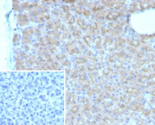 SMAD4 (Pancreatic Adenocarcinoma Marker) Antibody in Immunohistochemistry (Paraffin) (IHC (P))
