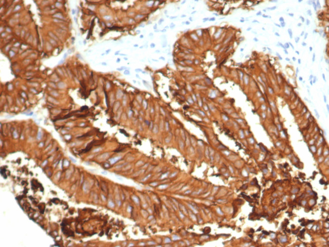 SMAD4/DPC4 (Pancreatic Adenocarcinoma Marker/Tumor Suppressor) Antibody in Immunohistochemistry (Paraffin) (IHC (P))