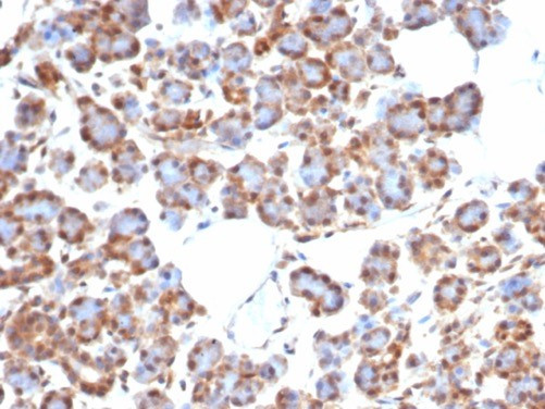 SMAD4/DPC4 (Pancreatic Adenocarcinoma Marker/Tumor Suppressor) Antibody in Immunohistochemistry (Paraffin) (IHC (P))