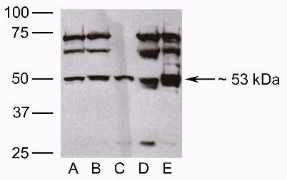 MINA53 Antibody in Western Blot (WB)