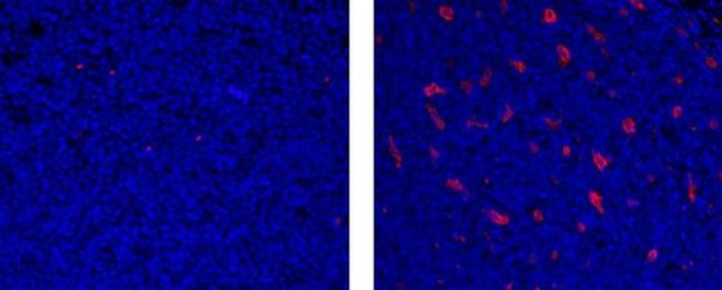 CD68 Antibody in Immunohistochemistry (Paraffin) (IHC (P))