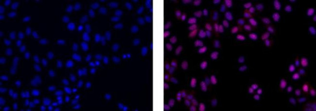 Mouse IgG2a Secondary Antibody in Immunocytochemistry (ICC/IF)