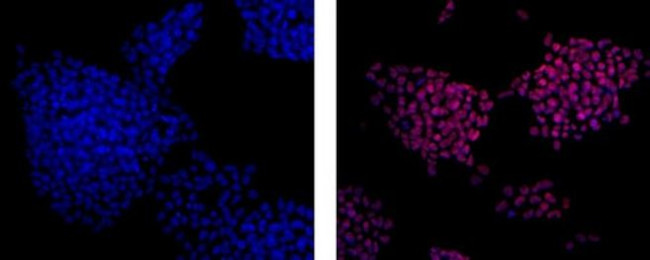 Rat IgG2a Secondary Antibody in Immunocytochemistry (ICC/IF)