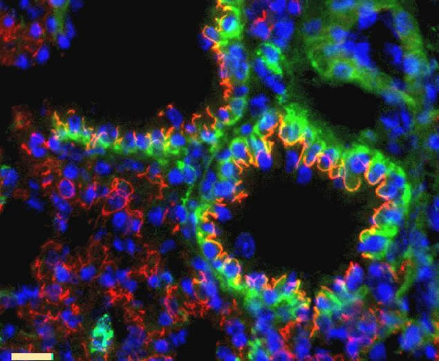 Claudin 10 Antibody in Immunohistochemistry (IHC)