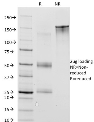 MAGE-1 (Target for Cancer Immunotherapy) Antibody in SDS-PAGE (SDS-PAGE)