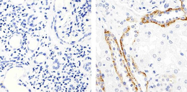 Claudin 10 Antibody in Immunohistochemistry (Paraffin) (IHC (P))