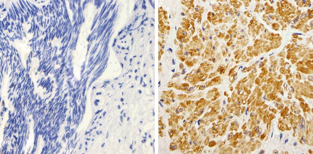 K-Ras Antibody in Immunohistochemistry (Paraffin) (IHC (P))