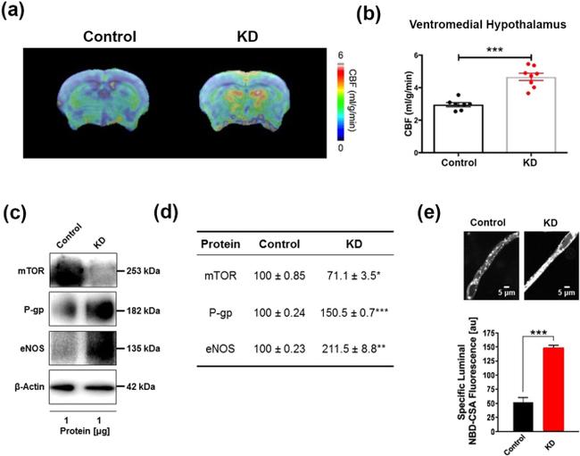 P-Glycoprotein Antibody in Western Blot (WB)