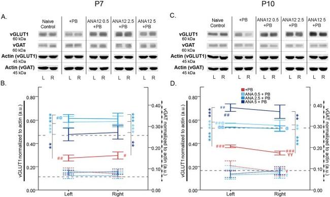 VGAT Antibody in Western Blot (WB)