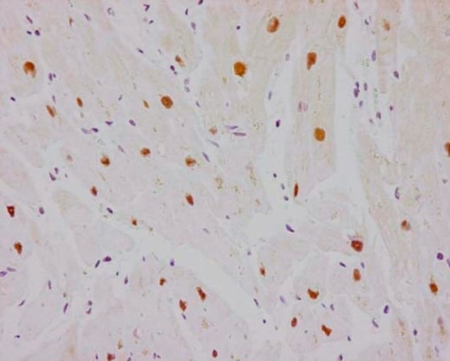 ESRRA Antibody in Immunohistochemistry (Paraffin) (IHC (P))