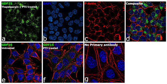 GDF15 Antibody in Immunocytochemistry (ICC/IF)