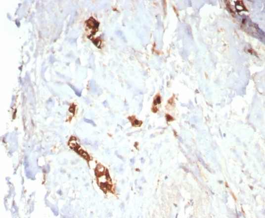 Mammaglobin (SCGB2A2) (Breast Cancer Marker) Antibody in Immunohistochemistry (Paraffin) (IHC (P))