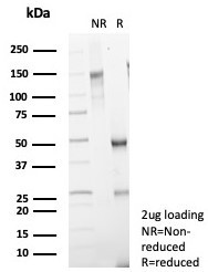 Mammaglobin (SCGB2A2) (Breast Cancer Marker) Antibody in SDS-PAGE (SDS-PAGE)