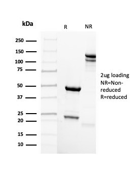 Mammaglobin (SCGB2A2) (Breast Cancer Marker) Antibody in SDS-PAGE (SDS-PAGE)