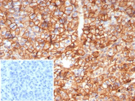 CD99/MIC2 (Ewing's Sarcoma Marker) Recombinant Monoclonal Antibody  (MIC2/8119R) (4267-RBM19-P0)