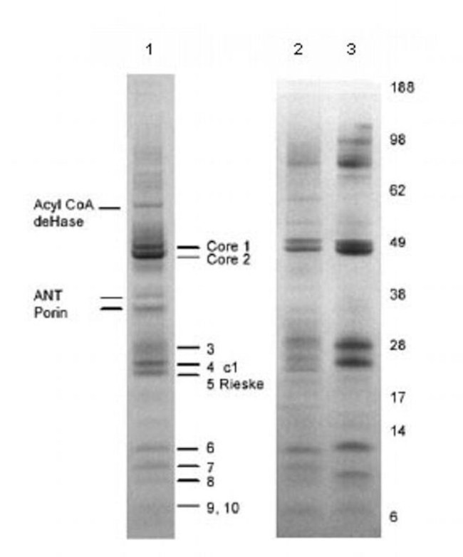 Complex III Antibody in Immunoprecipitation (IP)