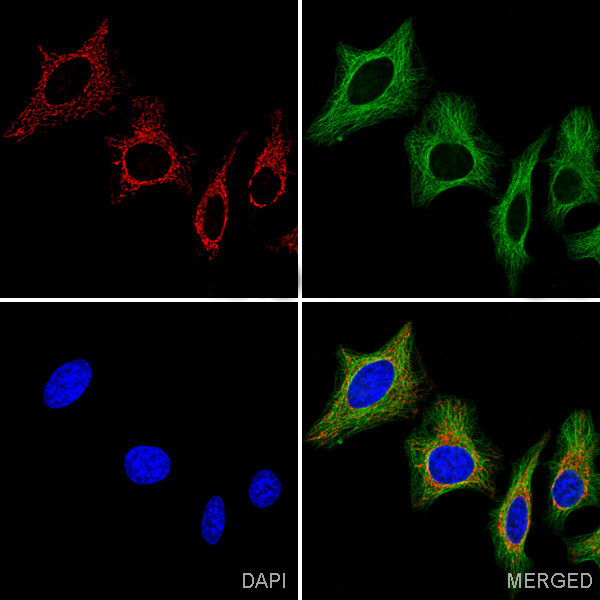 ATP5A1 Antibody in Immunocytochemistry (ICC/IF)