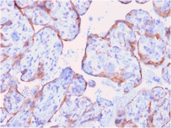 MMP3 Antibody in Immunohistochemistry (Paraffin) (IHC (P))