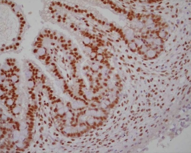 RXRA Antibody in Immunohistochemistry (Paraffin) (IHC (P))