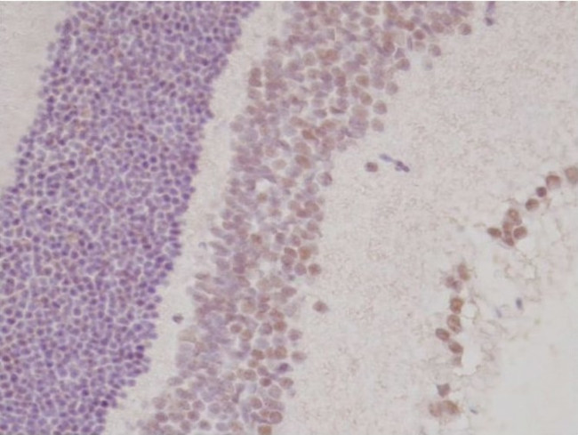 TLX Antibody in Immunohistochemistry (Paraffin) (IHC (P))