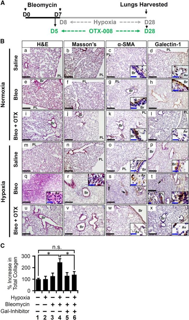 Galectin 1 Antibody in Immunohistochemistry (IHC)