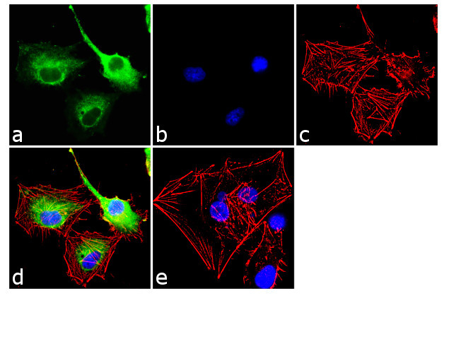 Galectin 1 Antibody in Immunocytochemistry (ICC/IF)