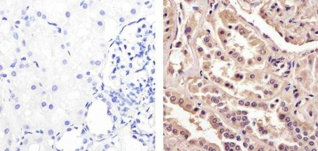 Galectin 1 Antibody in Immunohistochemistry (Paraffin) (IHC (P))