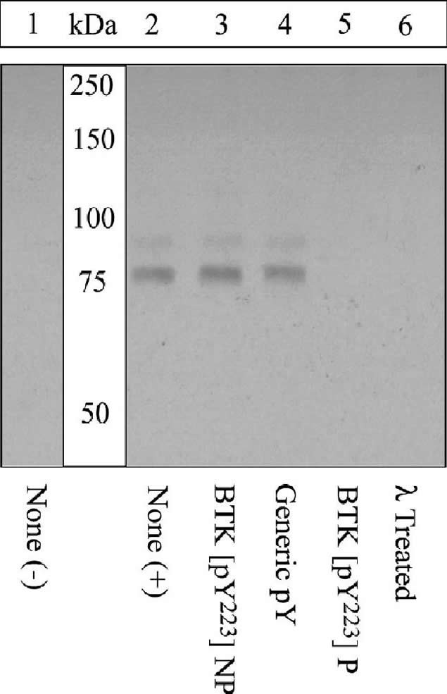 Phospho-Btk (Tyr223) Antibody in Western Blot (WB)