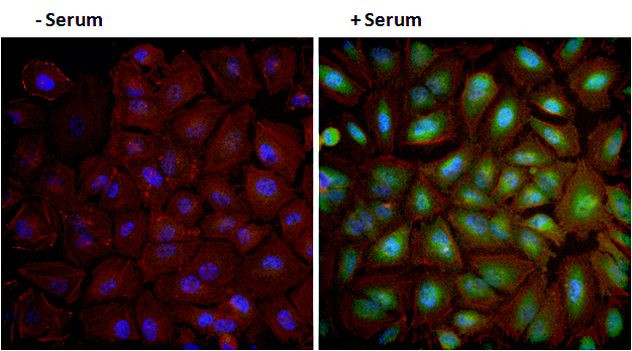 Phospho-AKT1 (Ser473) Antibody in Immunocytochemistry (ICC/IF)