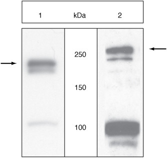 VEGF Receptor 2 Antibody in Western Blot (WB)