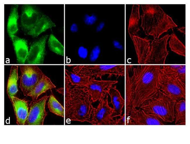 Phospho-mTOR (Ser2448) Antibody