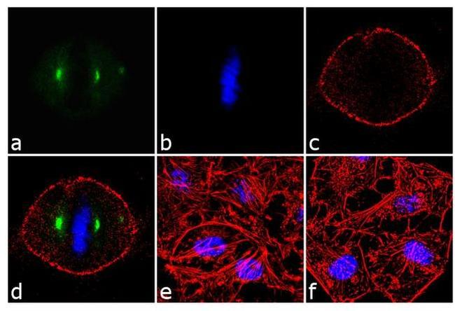 Phospho-Aurora A (Thr288) Antibody