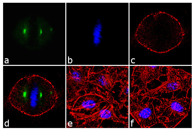 Phospho-Aurora A (Thr288) Antibody in Immunocytochemistry (ICC/IF)