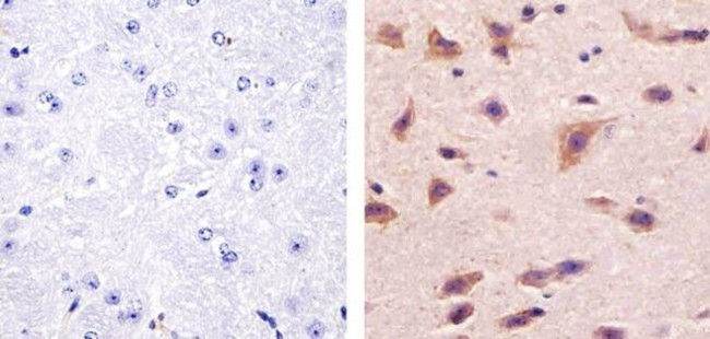 Phospho-Aurora A (Thr288) Antibody in Immunohistochemistry (Paraffin) (IHC (P))