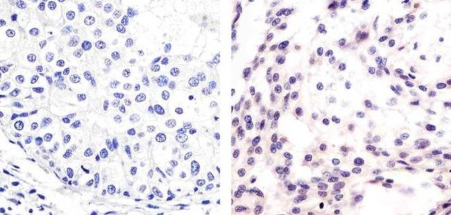 Phospho-MDM2 (Ser166) Antibody in Immunohistochemistry (Paraffin) (IHC (P))