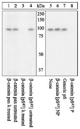 Phospho-beta Catenin (Ser45) Antibody in Western Blot (WB)