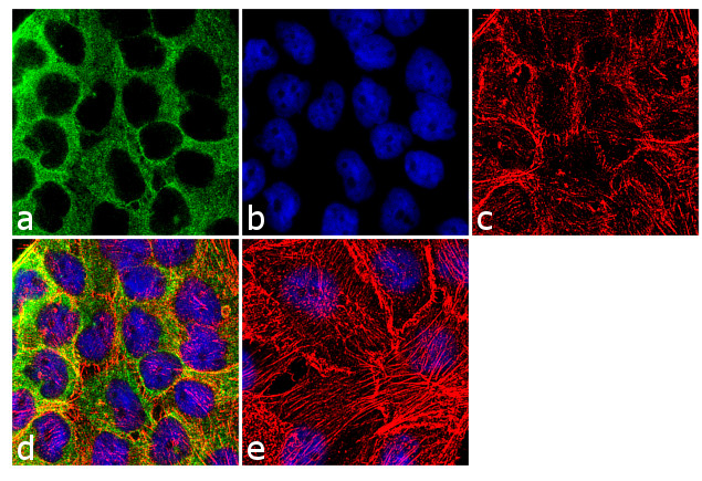 Phospho-beta Catenin (Ser45) Antibody in Immunocytochemistry (ICC/IF)