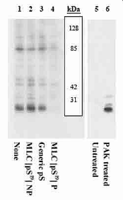 Phospho-MYLK (Ser19) Antibody in Western Blot (WB)