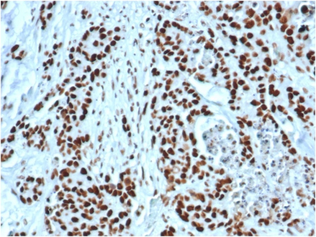 MSH2 Antibody in Immunohistochemistry (Paraffin) (IHC (P))